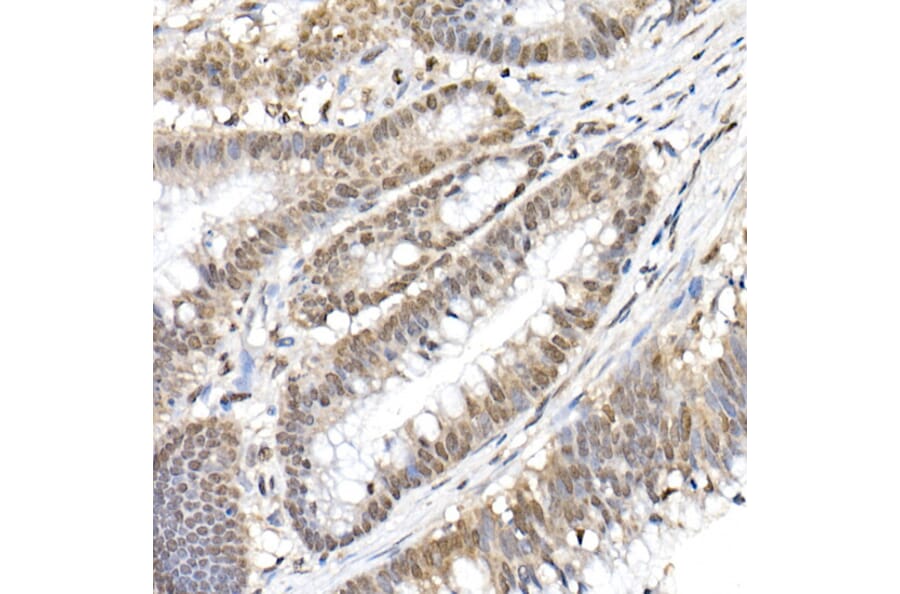 Immunohistochemistry - Anti-NF-kB p65 (phospho Ser536) Antibody (A91007) - Antibodies.com