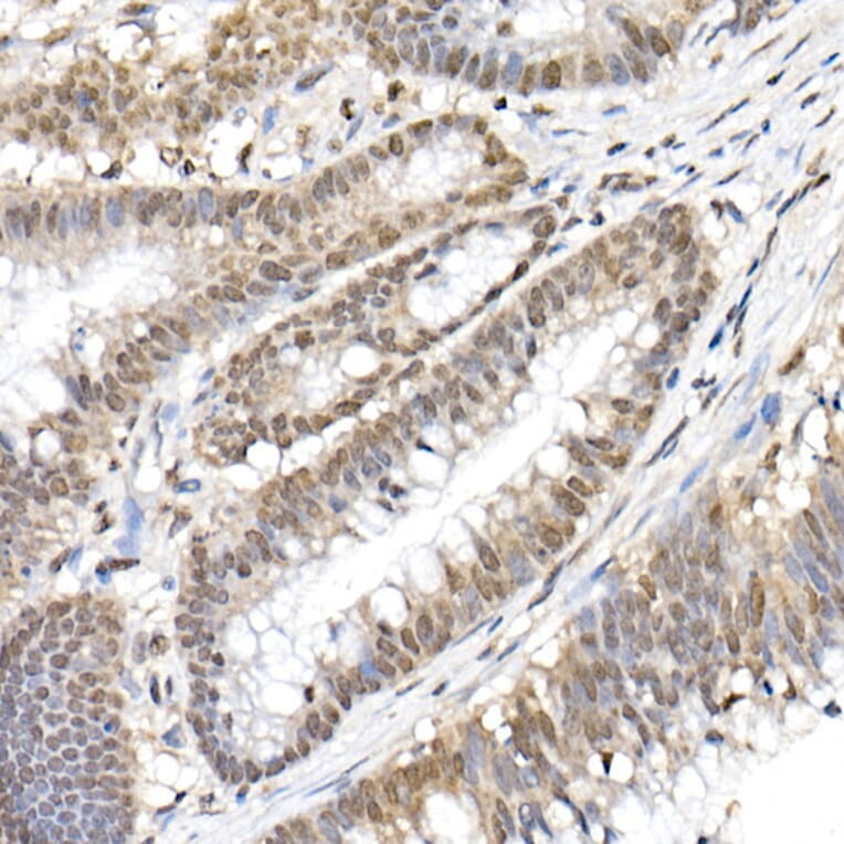 Immunohistochemistry - Anti-NF-kB p65 (phospho Ser536) Antibody (A91007) - Antibodies.com