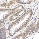 Immunohistochemistry - Anti-NF-kB p65 (phospho Ser536) Antibody (A91007) - Antibodies.com