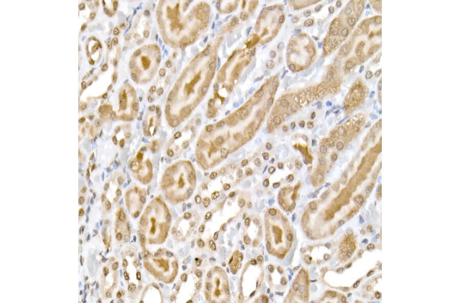 Immunohistochemistry - Anti-NF-kB p65 (phospho Ser536) Antibody (A91007) - Antibodies.com