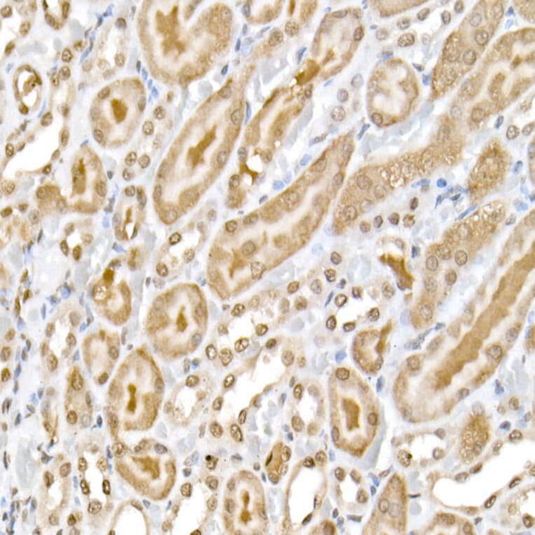 Immunohistochemistry - Anti-NF-kB p65 (phospho Ser536) Antibody (A91007) - Antibodies.com