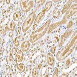 Immunohistochemistry - Anti-NF-kB p65 (phospho Ser536) Antibody (A91007) - Antibodies.com
