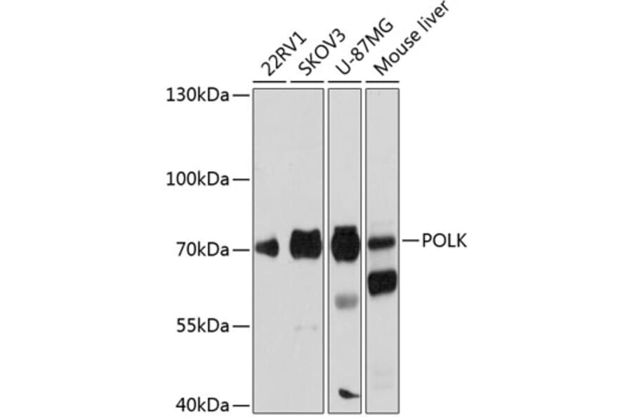 Western Blot - Anti-DNA Polymerase Kappa/POLK Antibody (A91008) - Antibodies.com