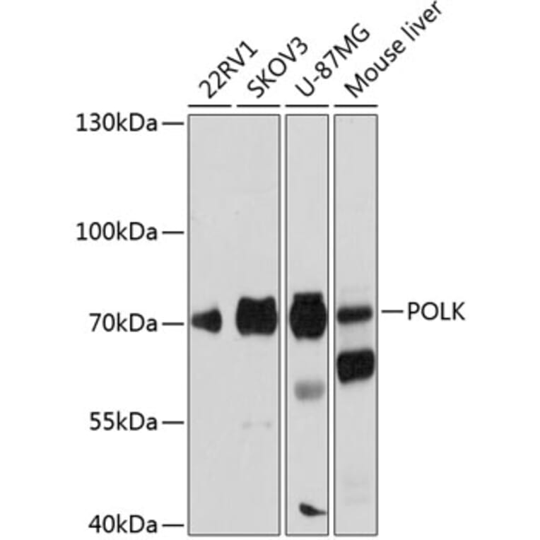 Western Blot - Anti-DNA Polymerase Kappa/POLK Antibody (A91008) - Antibodies.com