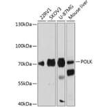 Western Blot - Anti-DNA Polymerase Kappa/POLK Antibody (A91008) - Antibodies.com