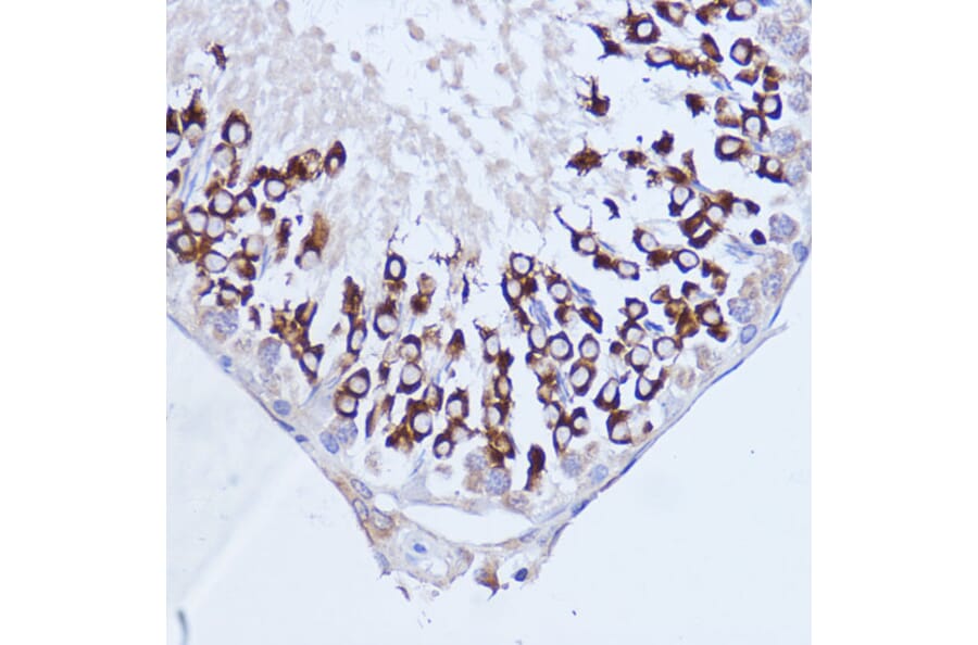 Immunohistochemistry - Anti-PABP Antibody (A91009) - Antibodies.com