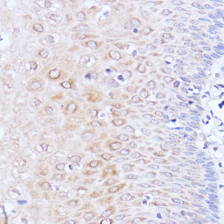 Immunohistochemistry - Anti-PABP Antibody (A91009) - Antibodies.com