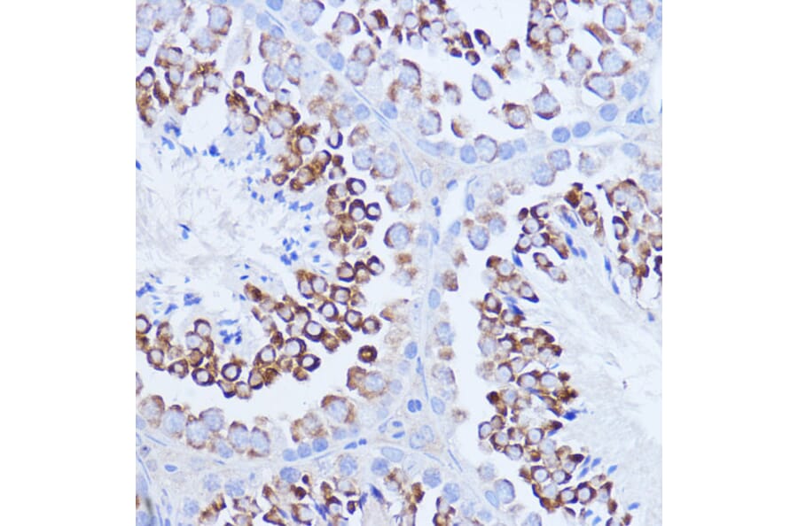 Immunohistochemistry - Anti-PABP Antibody (A91009) - Antibodies.com