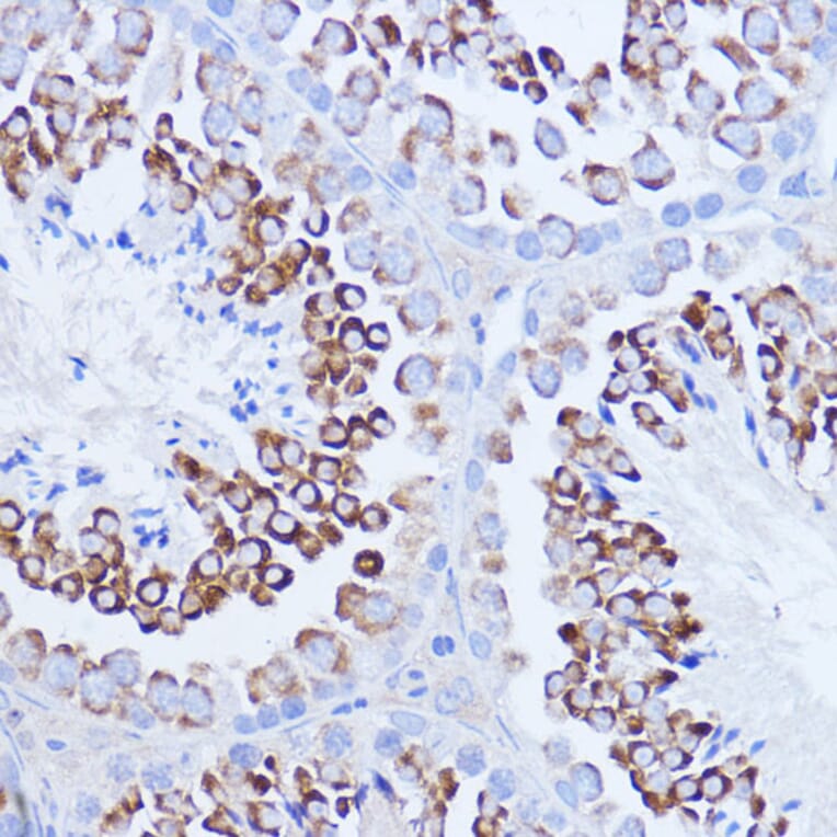 Immunohistochemistry - Anti-PABP Antibody (A91009) - Antibodies.com