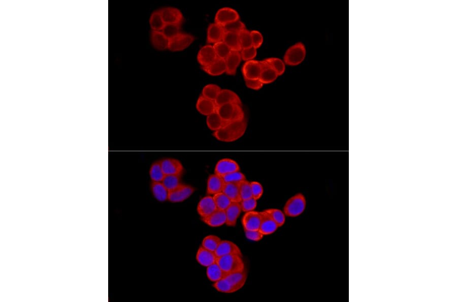 Immunofluorescence - Anti-PABP Antibody (A91009) - Antibodies.com