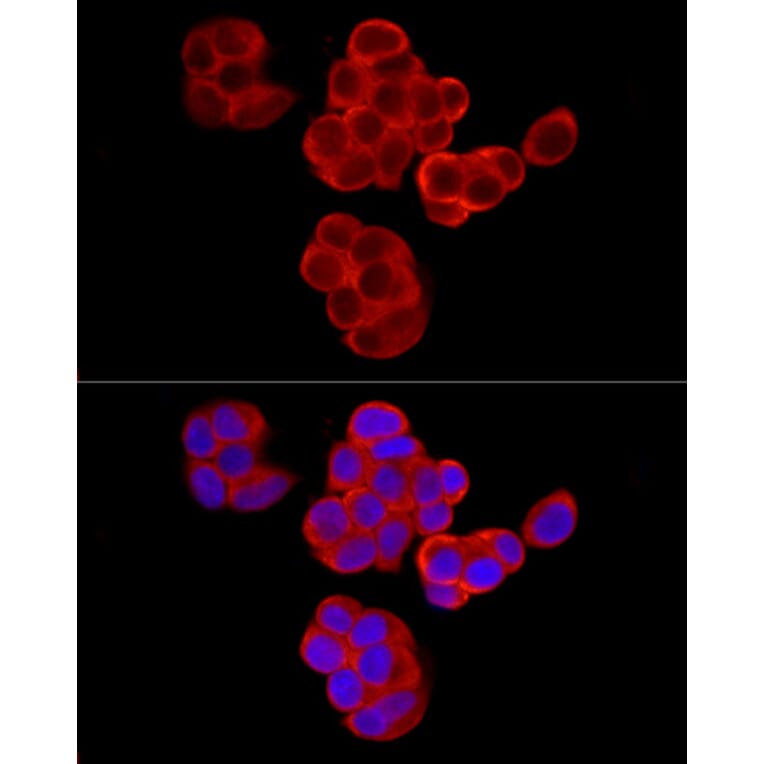Immunofluorescence - Anti-PABP Antibody (A91009) - Antibodies.com