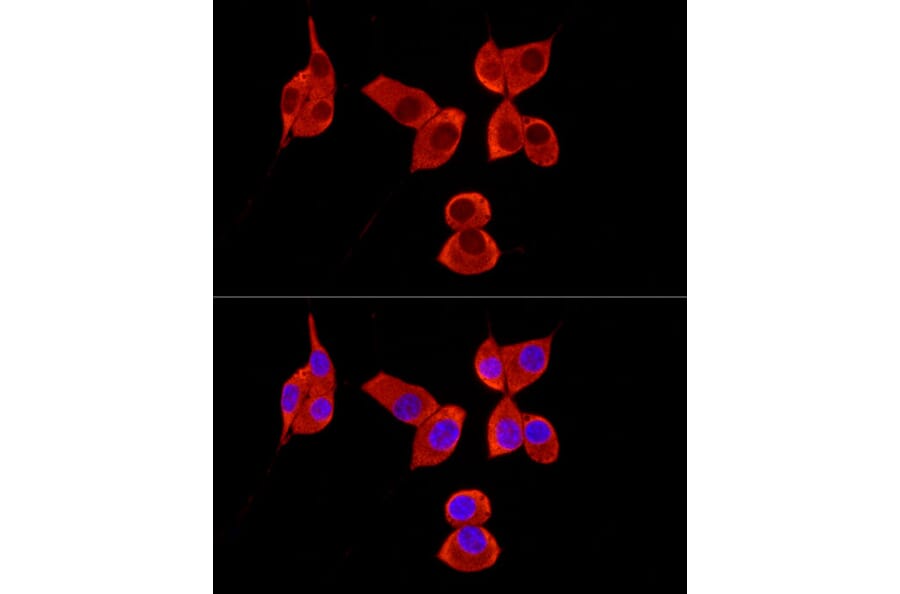 Immunofluorescence - Anti-PABP Antibody (A91009) - Antibodies.com