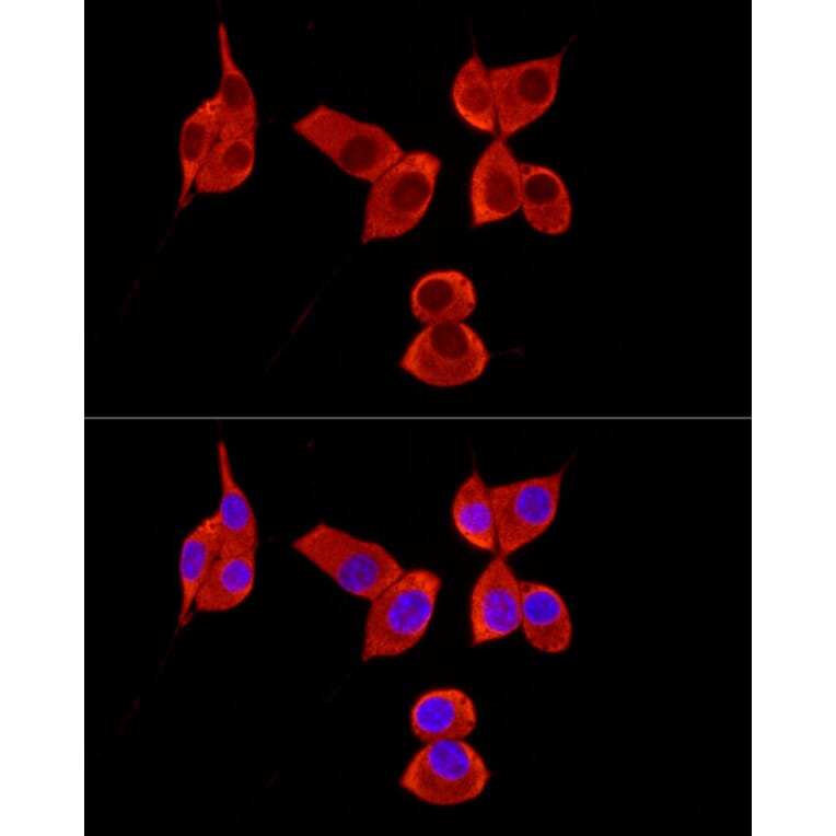 Immunofluorescence - Anti-PABP Antibody (A91009) - Antibodies.com