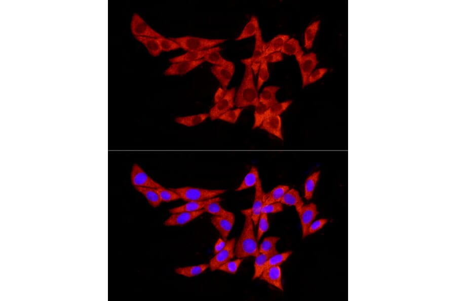 Immunofluorescence - Anti-PABP Antibody (A91009) - Antibodies.com