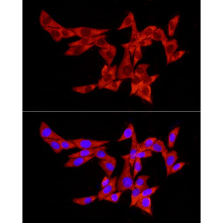 Immunofluorescence - Anti-PABP Antibody (A91009) - Antibodies.com