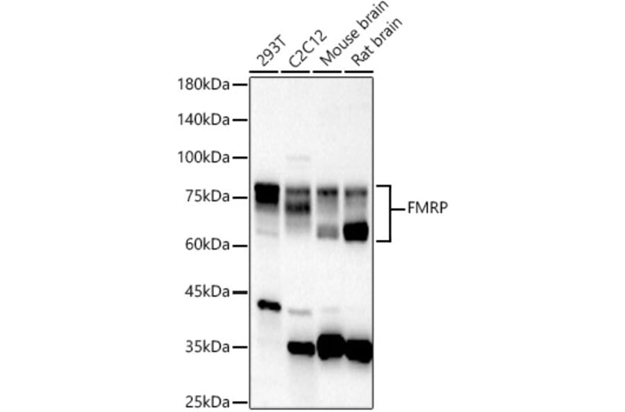 Western Blot - Anti-FMRP Antibody (A91010) - Antibodies.com