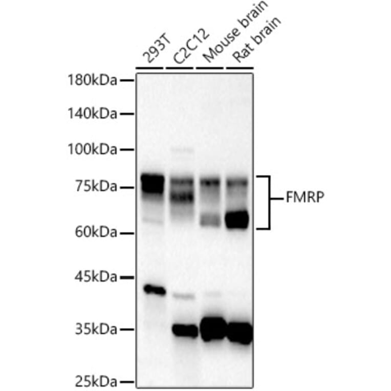 Western Blot - Anti-FMRP Antibody (A91010) - Antibodies.com