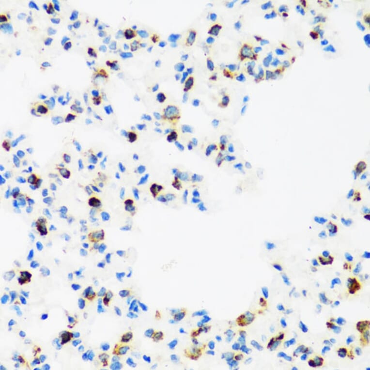 Immunohistochemistry - Anti-FMRP Antibody (A91010) - Antibodies.com