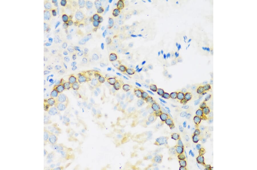 Immunohistochemistry - Anti-FMRP Antibody (A91010) - Antibodies.com