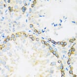 Immunohistochemistry - Anti-FMRP Antibody (A91010) - Antibodies.com