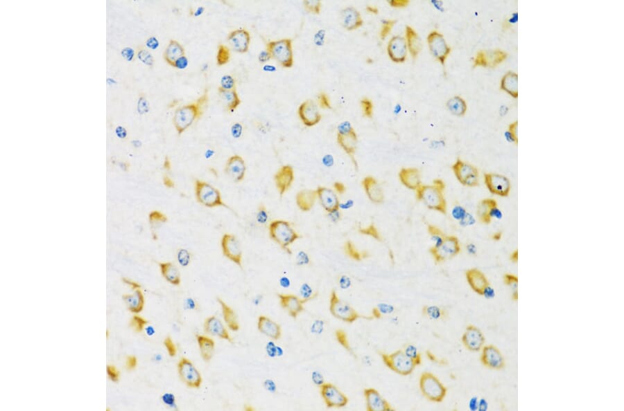 Immunohistochemistry - Anti-FMRP Antibody (A91010) - Antibodies.com