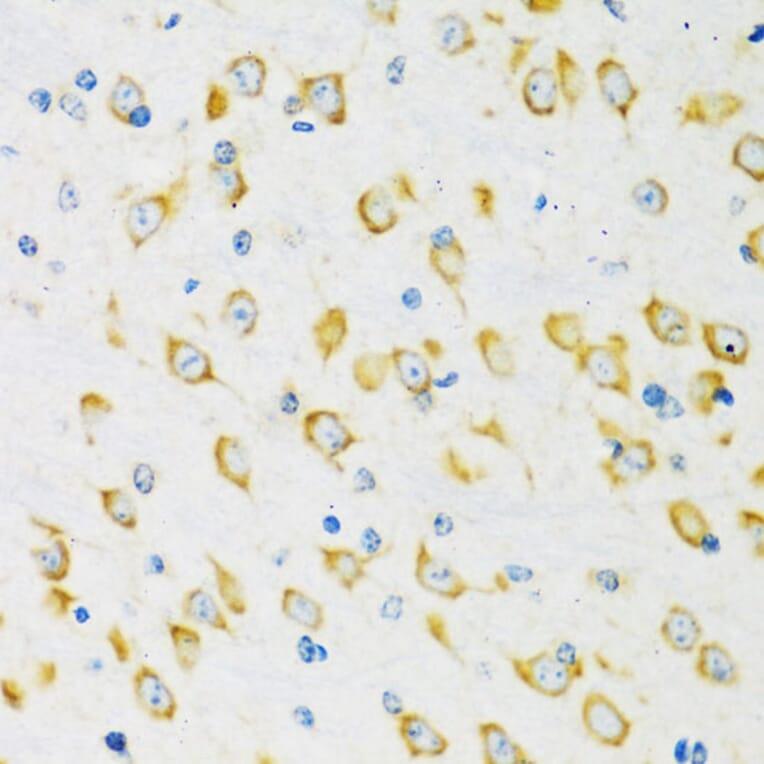 Immunohistochemistry - Anti-FMRP Antibody (A91010) - Antibodies.com