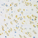 Immunohistochemistry - Anti-FMRP Antibody (A91010) - Antibodies.com