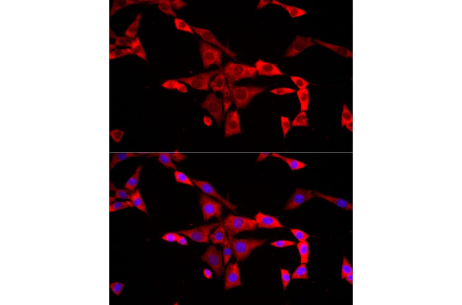 Immunofluorescence - Anti-FMRP Antibody (A91010) - Antibodies.com