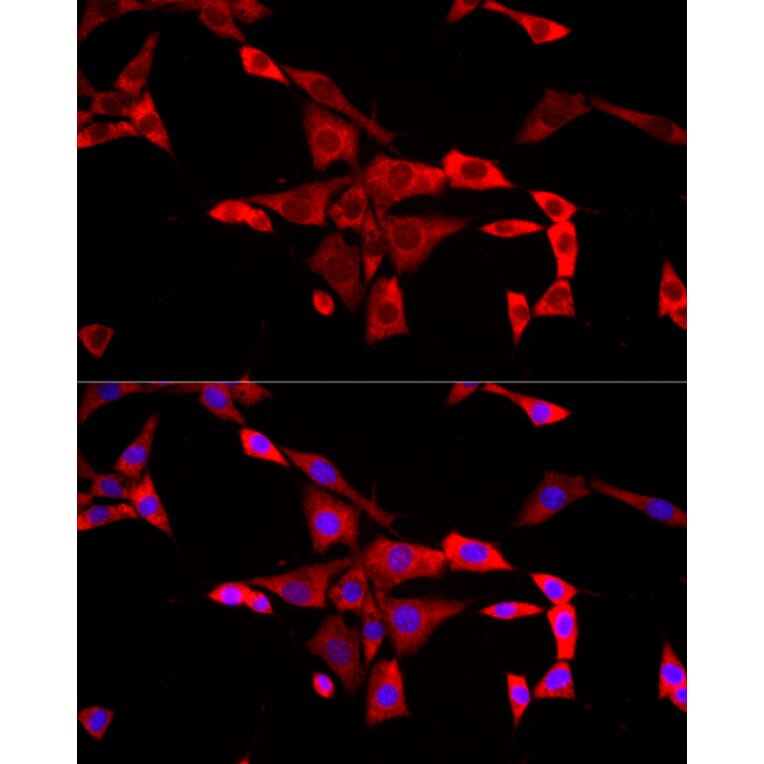 Immunofluorescence - Anti-FMRP Antibody (A91010) - Antibodies.com