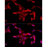 Immunofluorescence - Anti-FMRP Antibody (A91010) - Antibodies.com