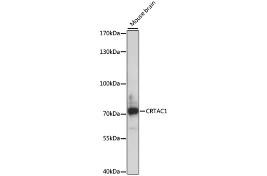 Western Blot - Anti-CRTAC1 Antibody (A91011) - Antibodies.com