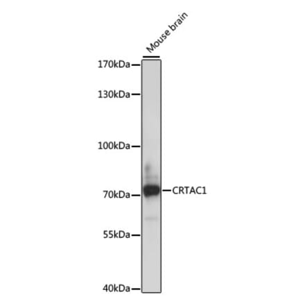 Western Blot - Anti-CRTAC1 Antibody (A91011) - Antibodies.com