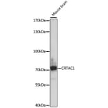 Western Blot - Anti-CRTAC1 Antibody (A91011) - Antibodies.com
