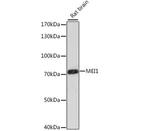 Western Blot - Anti-MEI1 Antibody (A91012) - Antibodies.com