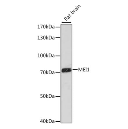 Western Blot - Anti-MEI1 Antibody (A91012) - Antibodies.com