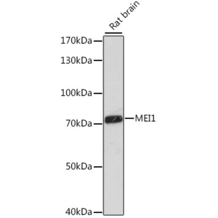 Western Blot - Anti-MEI1 Antibody (A91012) - Antibodies.com