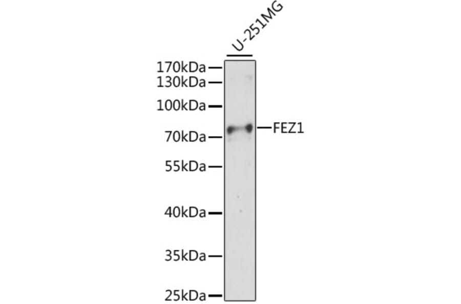 Western Blot - Anti-FEZ1 Antibody (A91013) - Antibodies.com