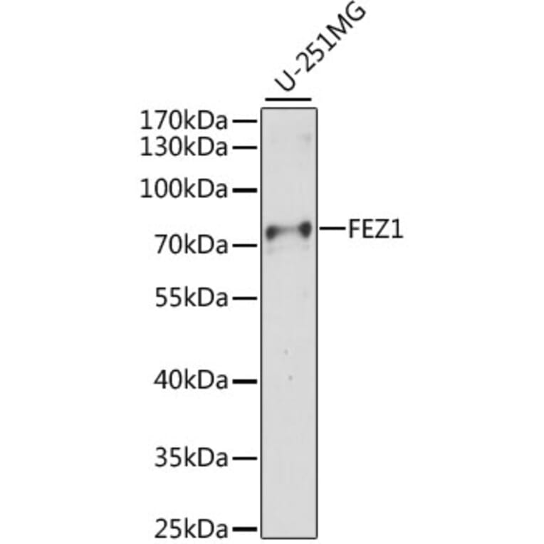 Western Blot - Anti-FEZ1 Antibody (A91013) - Antibodies.com