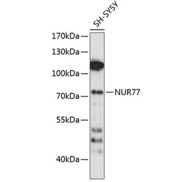 Western Blot - Anti-NUR77 Antibody (A91014) - Antibodies.com