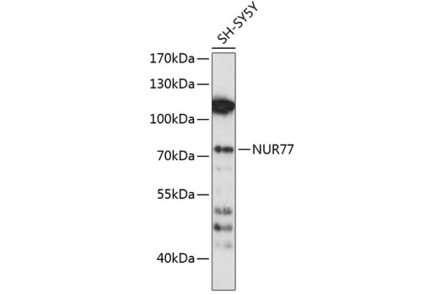 Western Blot - Anti-NUR77 Antibody (A91014) - Antibodies.com