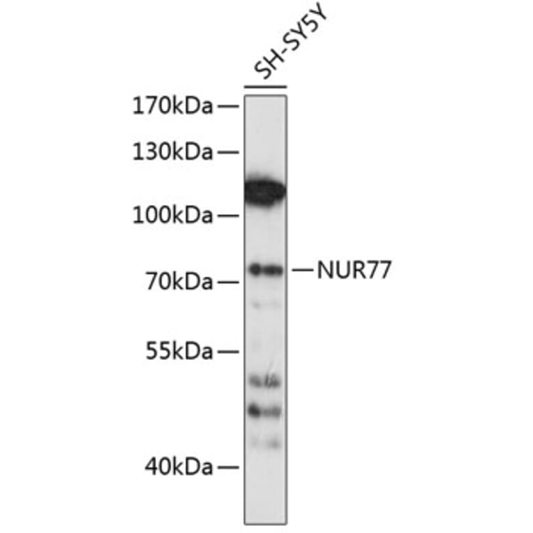 Western Blot - Anti-NUR77 Antibody (A91014) - Antibodies.com