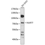 Western Blot - Anti-NUR77 Antibody (A91014) - Antibodies.com