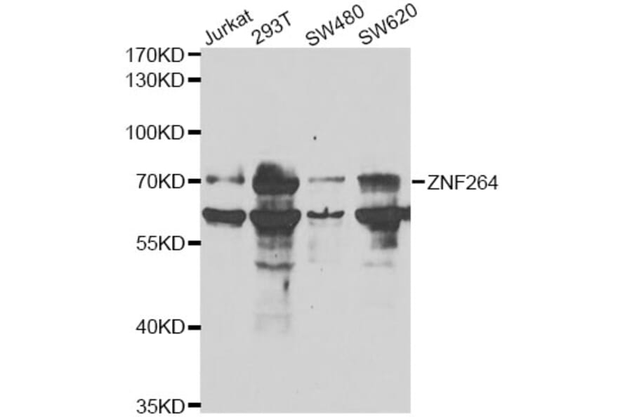 Western Blot - Anti-ZNF264 Antibody (A14089) - Antibodies.com