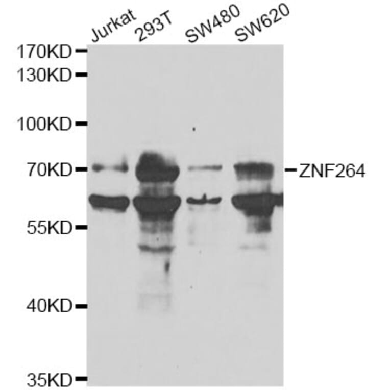 Western Blot - Anti-ZNF264 Antibody (A14089) - Antibodies.com