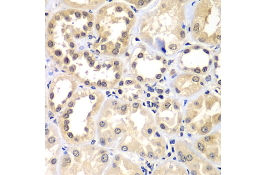 Immunohistochemistry - Anti-ZNF264 Antibody (A14089) - Antibodies.com