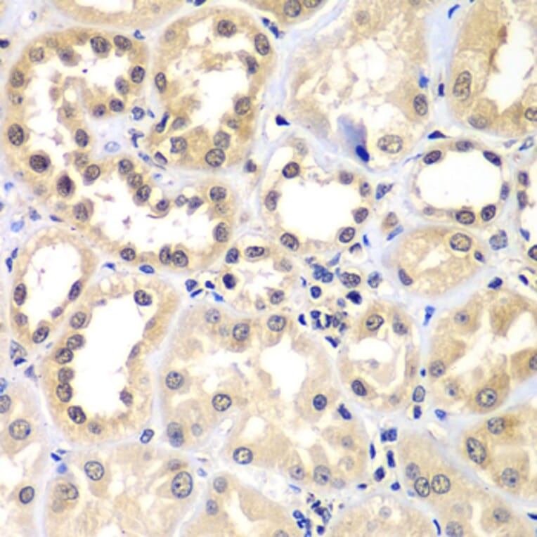 Immunohistochemistry - Anti-ZNF264 Antibody (A14089) - Antibodies.com