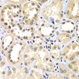 Immunohistochemistry - Anti-ZNF264 Antibody (A14089) - Antibodies.com