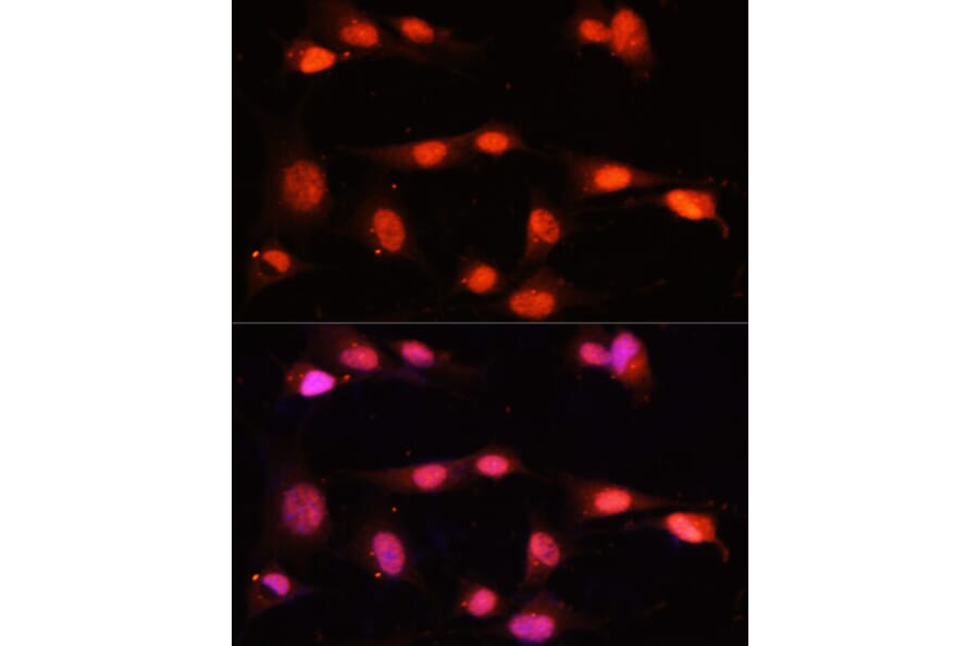 Immunofluorescence - Anti-ZNF264 Antibody (A14089) - Antibodies.com