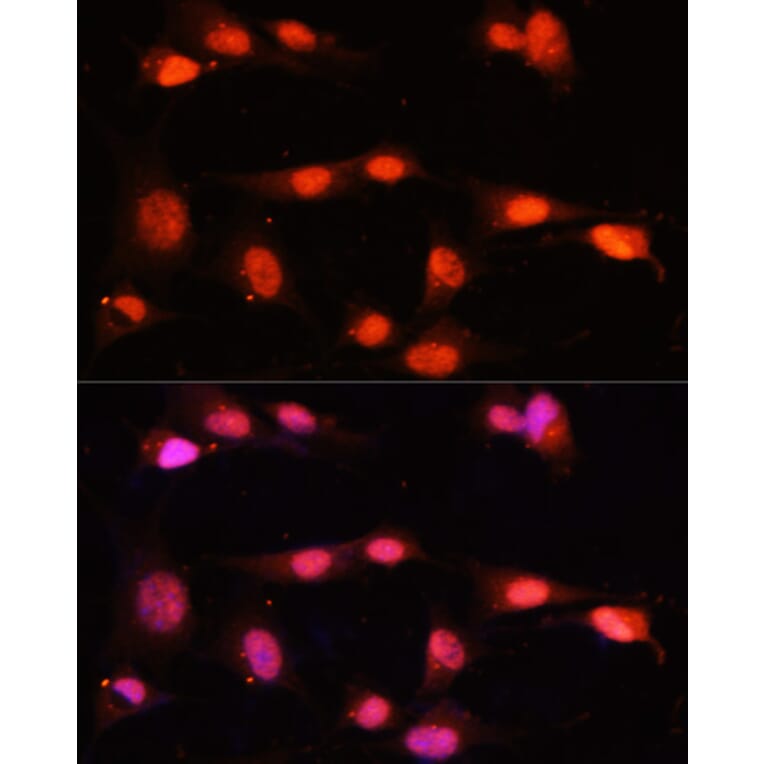 Immunofluorescence - Anti-ZNF264 Antibody (A14089) - Antibodies.com