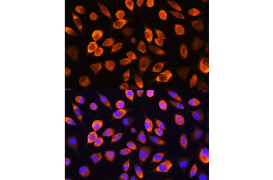 Immunofluorescence - Anti-Hsc70 Antibody (A91017) - Antibodies.com